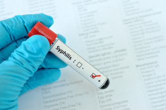 kırmızı ve siyah etiketli bir test tüpü tutan bir el