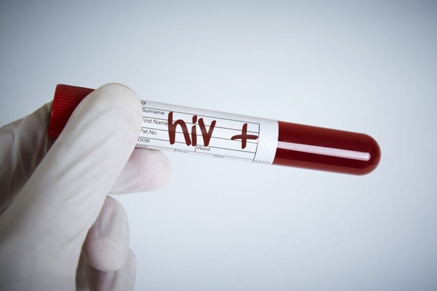 HIV pozitif gösteren test